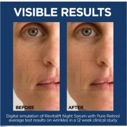 L’Oréal Paris Revitalift Derm Intensives Revitalift-Derm-Intensives-Night-Serum-03-Pure-Retinol -Loreal Cares Store 071249419182 t3