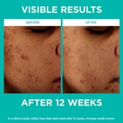 L’Oréal Paris Bright Reveal Bright-reveal-12-niacinamide-amino-sulfonic-ferulic-acid-dark-spot-serum