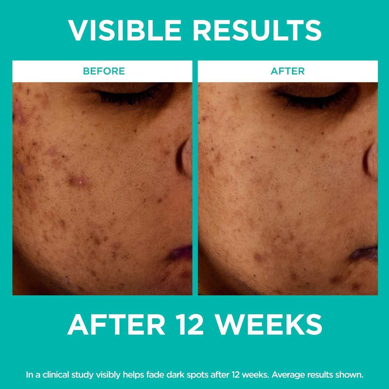 L’Oréal Paris Bright Reveal Bright-reveal-12-niacinamide-amino-sulfonic-ferulic-acid-dark-spot-serum 3 L’Oréal Paris Bright Reveal Bright-reveal-12-niacinamide-amino-sulfonic-ferulic-acid-dark-spot-serum